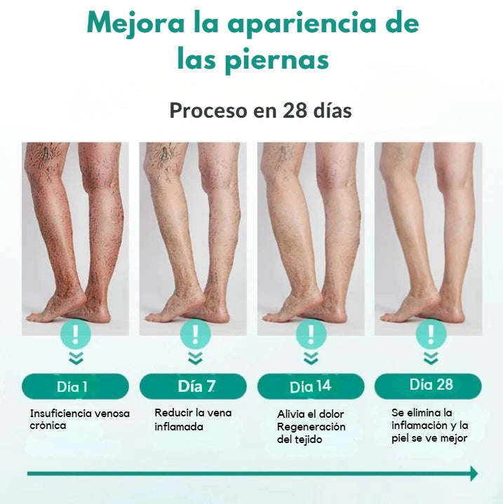 Parche para venas varicosas Timilk®