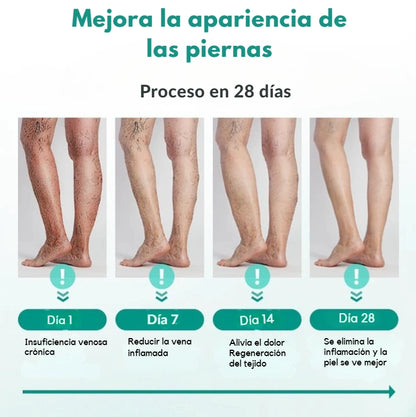 Parche para venas varicosas Timilk®